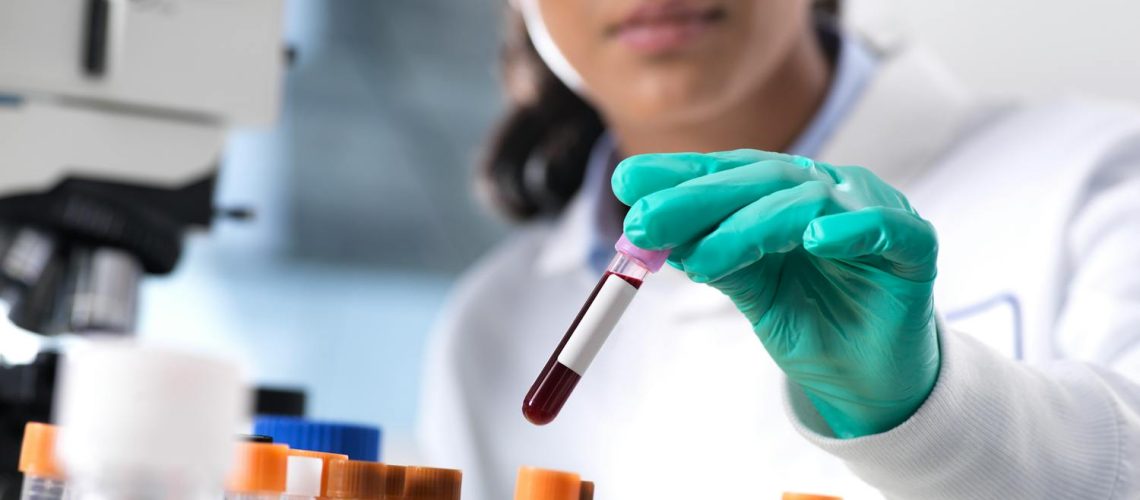 Lymphopénie : comprendre la baisse des lymphocytes et ses causes Lymphopénie : comprendre la baisse des lymphocytes et ses causes